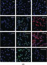 Rabbit IgG (H+L) Highly Cross-Adsorbed Secondary Antibody in Immunocytochemistry (ICC/IF)