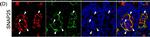Mouse IgG (H+L) Cross-Adsorbed Secondary Antibody in Immunohistochemistry (IHC)