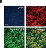 Mouse IgG (H+L) Cross-Adsorbed Secondary Antibody in Immunohistochemistry (IHC)