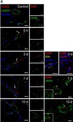 Mouse IgG (H+L) Cross-Adsorbed Secondary Antibody in Immunocytochemistry (ICC/IF)