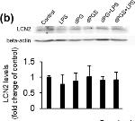 Rat IgG (H+L) Secondary Antibody in Western Blot (WB)