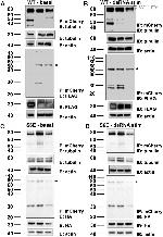 mCherry Antibody in Immunoprecipitation (IP)