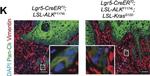 Rabbit IgG (H+L) Cross-Adsorbed Secondary Antibody in Immunohistochemistry (IHC)