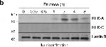 Rabbit IgG (H+L) Cross-Adsorbed Secondary Antibody in Western Blot (WB)