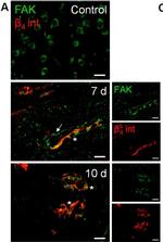 Rabbit IgG (H+L) Cross-Adsorbed Secondary Antibody in Immunocytochemistry (ICC/IF)