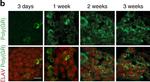 Rabbit IgG (H+L) Highly Cross-Adsorbed Secondary Antibody in Immunocytochemistry (ICC/IF)