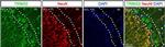 Mouse IgG (H+L) Highly Cross-Adsorbed Secondary Antibody in Immunohistochemistry (IHC)