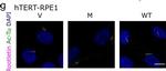 Mouse IgG (H+L) Cross-Adsorbed Secondary Antibody in Immunocytochemistry (ICC/IF)