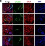 Rabbit IgG (H+L) Cross-Adsorbed Secondary Antibody in Immunocytochemistry (ICC/IF)