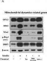 Rabbit IgG (H+L) Secondary Antibody in Western Blot (WB)