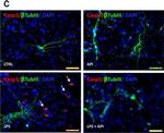 Rabbit IgG (H+L) Cross-Adsorbed Secondary Antibody in Immunocytochemistry (ICC/IF)