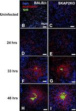 Rat IgG (H+L) Cross-Adsorbed Secondary Antibody in Immunohistochemistry (IHC)