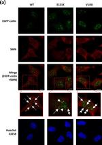 Mouse IgG (H+L) Secondary Antibody in Immunocytochemistry (ICC/IF)