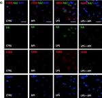 Rat IgG (H+L) Cross-Adsorbed Secondary Antibody in Immunocytochemistry (ICC/IF)