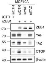 Mouse IgG (H+L) Secondary Antibody in Western Blot (WB)