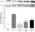 Rabbit IgG (H+L) Secondary Antibody in Western Blot (WB)