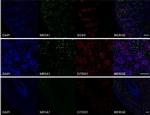 Rabbit IgG (H+L) Highly Cross-Adsorbed Secondary Antibody in Immunohistochemistry (IHC)