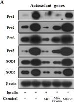 Rabbit IgG (H+L) Secondary Antibody in Western Blot (WB)