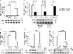 Rabbit IgG (H+L) Secondary Antibody in Western Blot (WB)