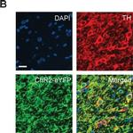 Mouse IgG (H+L) Cross-Adsorbed Secondary Antibody in Immunohistochemistry (IHC)