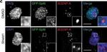 Mouse IgG (H+L) Cross-Adsorbed Secondary Antibody in Immunocytochemistry (ICC/IF)