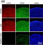 Rabbit IgG (Heavy chain) Secondary Antibody in Immunohistochemistry (PFA fixed) (IHC (PFA))