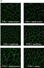 Mouse IgG (H+L) Highly Cross-Adsorbed Secondary Antibody in Immunohistochemistry (Frozen) (IHC (F))