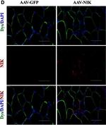 Rabbit IgG (H+L) Highly Cross-Adsorbed Secondary Antibody in Immunohistochemistry (IHC)