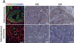 Rabbit IgG (H+L) Highly Cross-Adsorbed Secondary Antibody in Immunohistochemistry (IHC)