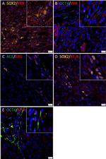 Mouse IgG (H+L) Highly Cross-Adsorbed Secondary Antibody in Immunocytochemistry (ICC/IF)