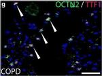 Mouse IgG (H+L) Cross-Adsorbed Secondary Antibody in Immunohistochemistry (IHC)