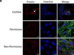 Rabbit IgG (H+L) Highly Cross-Adsorbed Secondary Antibody in Immunocytochemistry (ICC/IF)