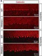 Mouse IgG (H+L) Highly Cross-Adsorbed Secondary Antibody in Immunohistochemistry (IHC)