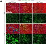 Rabbit IgG (H+L) Highly Cross-Adsorbed Secondary Antibody in Immunohistochemistry (IHC)