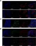 Rabbit IgG (H+L) Highly Cross-Adsorbed Secondary Antibody in Immunohistochemistry (IHC)