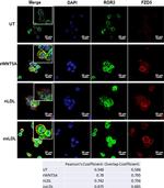 Mouse IgG (H+L) Cross-Adsorbed Secondary Antibody in Immunocytochemistry (ICC/IF)