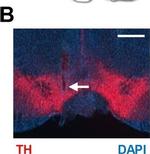 Mouse IgG (H+L) Cross-Adsorbed Secondary Antibody in Immunohistochemistry (IHC)