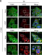 Mouse IgG1 Cross-Adsorbed Secondary Antibody in Immunocytochemistry (ICC/IF)