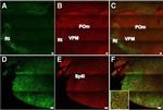 Rabbit IgG (H+L) Highly Cross-Adsorbed Secondary Antibody in Immunohistochemistry (IHC)