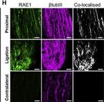 Rabbit IgG (H+L) Highly Cross-Adsorbed Secondary Antibody in Immunocytochemistry (ICC/IF)