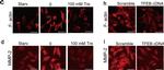 Mouse IgG (H+L) Highly Cross-Adsorbed Secondary Antibody in Immunocytochemistry (ICC/IF)