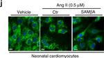 Rabbit IgG (H+L) Secondary Antibody in Immunocytochemistry (ICC/IF)