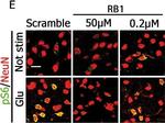 Mouse IgG (H+L) Cross-Adsorbed Secondary Antibody in Immunohistochemistry (IHC)