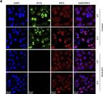 Mouse IgG (H+L) Cross-Adsorbed Secondary Antibody in Immunocytochemistry (ICC/IF)