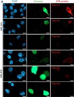 Mouse IgG (H+L) Cross-Adsorbed Secondary Antibody in Immunocytochemistry (ICC/IF)