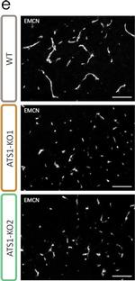 Rat IgG (H+L) Highly Cross-Adsorbed Secondary Antibody in Immunohistochemistry (IHC)