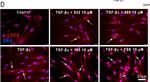 Rabbit IgG (H+L) Cross-Adsorbed Secondary Antibody in Immunocytochemistry (ICC/IF)