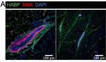 Rabbit IgG (H+L) Cross-Adsorbed Secondary Antibody in Immunohistochemistry (Paraffin) (IHC (P))