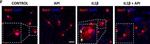 Rabbit IgG (H+L) Cross-Adsorbed Secondary Antibody in Immunocytochemistry (ICC/IF)