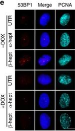 Rabbit IgG (H+L) Highly Cross-Adsorbed Secondary Antibody in Immunocytochemistry (ICC/IF)